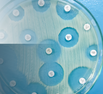 WEBSEMINAR: NUEVO USO DE LOS  ANTIMICROBIANOS ¿QUÉ  NECESITAMOS SABER?