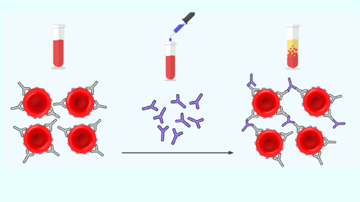 CURSO ONLINE DE AUTOAPRENDIZAJE: INTERPRETACIÓN DE RESULTADOS DE LABORATORIO